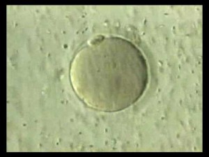 fertilização in vitro 2